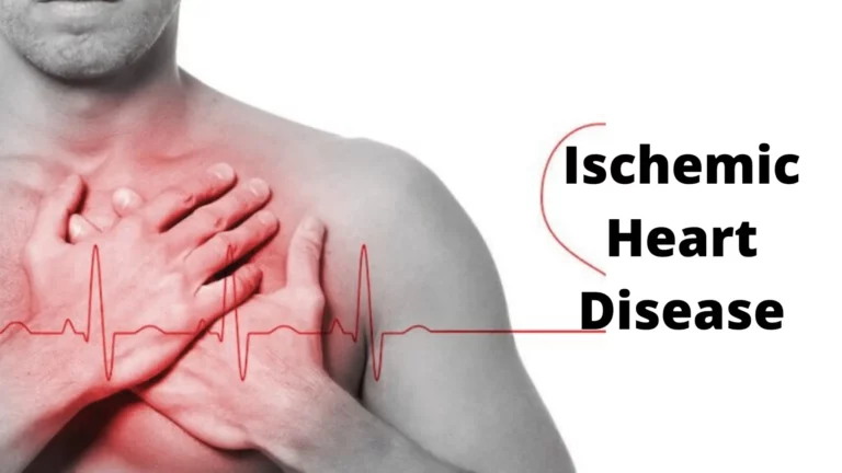 Ischemic Heart Disease- Symptoms, diagnosis, risk factors, and treatment